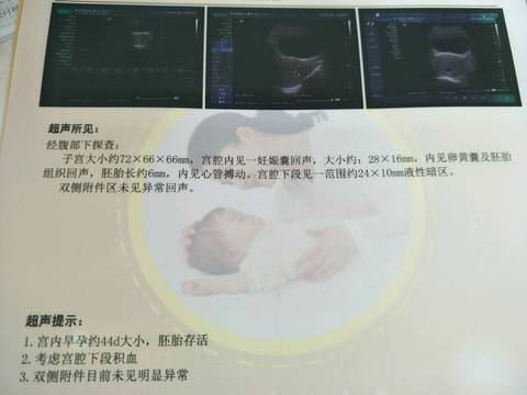 journal_insert_pic_987310968