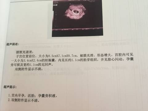 journal_insert_pic_987542365