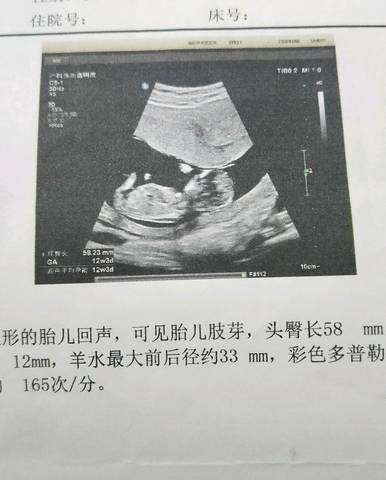 journal_insert_pic_987954494
