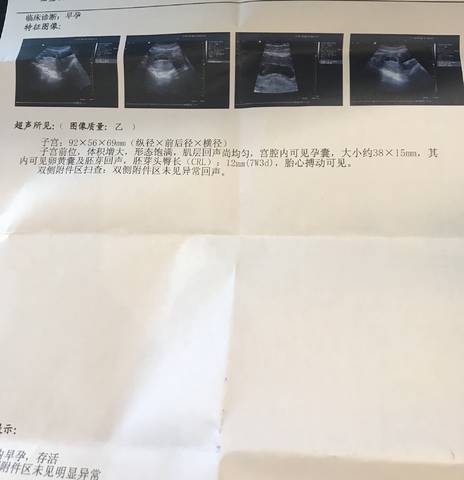 journal_insert_pic_990134637