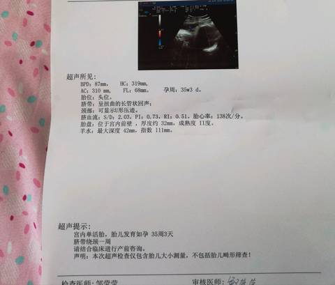 journal_insert_pic_991138092