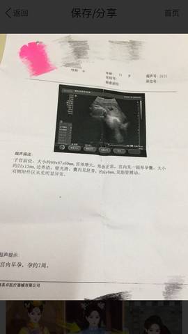 journal_insert_pic_991315773