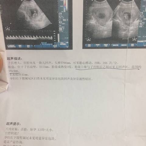 journal_insert_pic_992169997