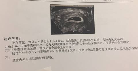 journal_insert_pic_991890204