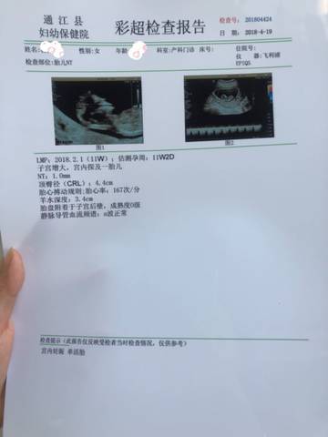 journal_insert_pic_993040927