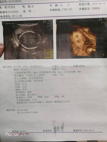 journal_insert_pic_992995507