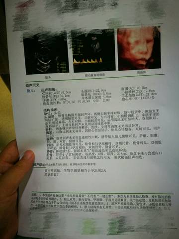 journal_insert_pic_993904209