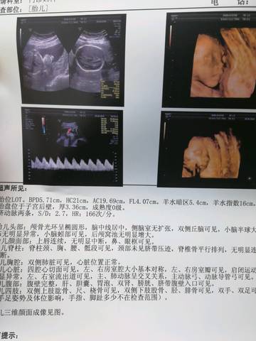journal_insert_pic_994062671