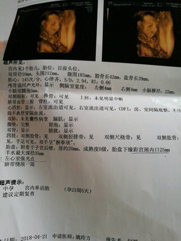 journal_insert_pic_994627730