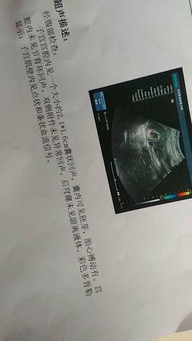 journal_insert_pic_995208536