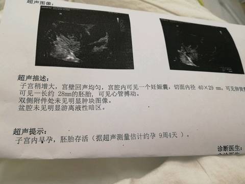 journal_insert_pic_995545978