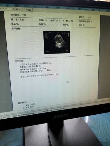 journal_insert_pic_996150195