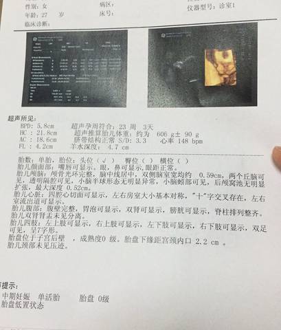 journal_insert_pic_997118501