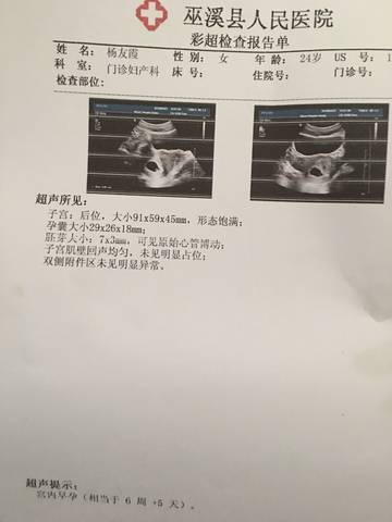 journal_insert_pic_998812744