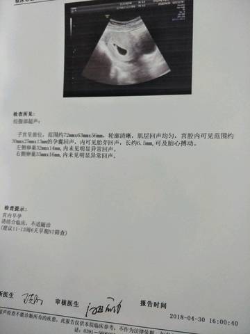 journal_insert_pic_1000999293