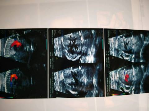journal_insert_pic_1000898063