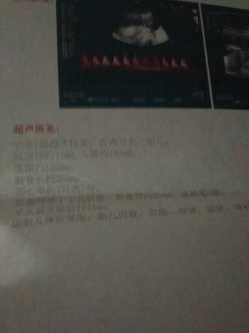 journal_insert_pic_1001147640