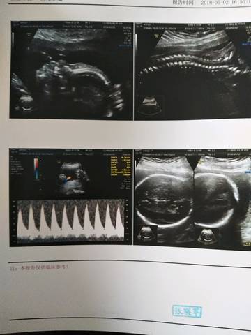 journal_insert_pic_1002798316