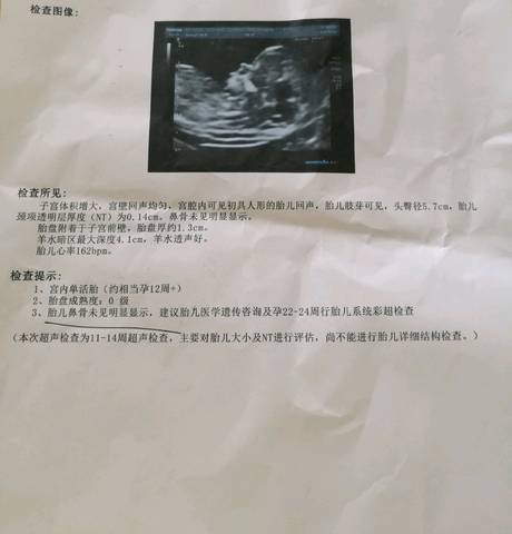 journal_insert_pic_1002509205