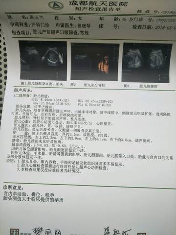 journal_insert_pic_1004290801