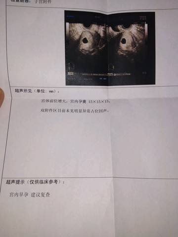 journal_insert_pic_1004818633
