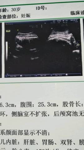 journal_insert_pic_1007042541