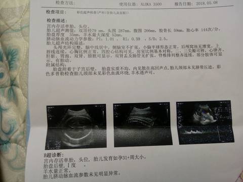 journal_insert_pic_1007444937