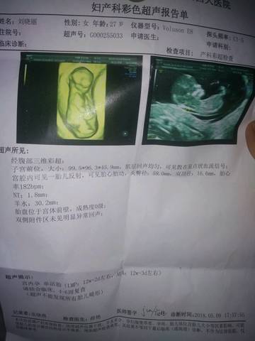 journal_insert_pic_1008170455
