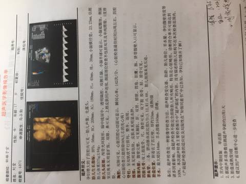 journal_insert_pic_1007749070