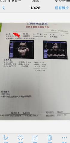 journal_insert_pic_1009864255