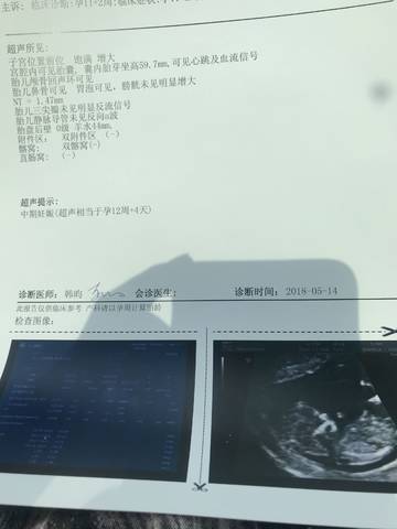 journal_insert_pic_1011394218