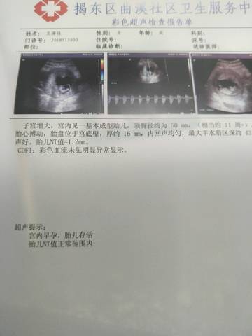 journal_insert_pic_1012180167