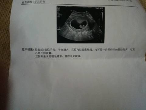 journal_insert_pic_1013143226