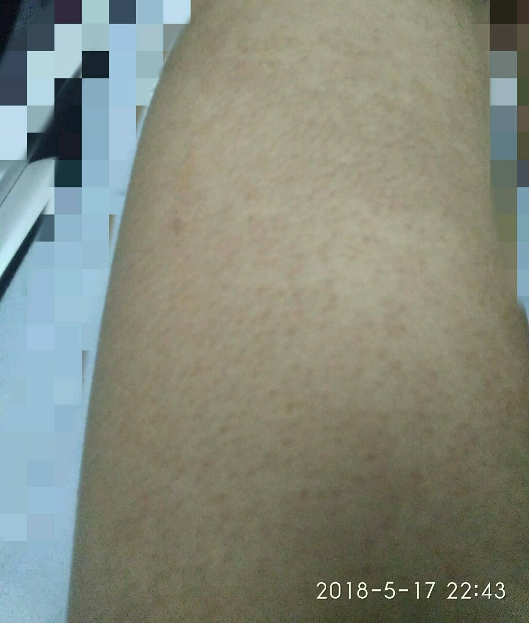 有宝妈是这样的皮肤吗