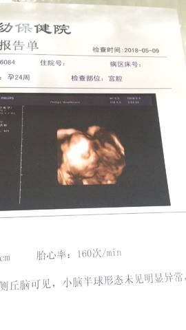 journal_insert_pic_1014802493