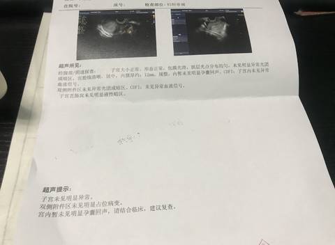 journal_insert_pic_1016222562