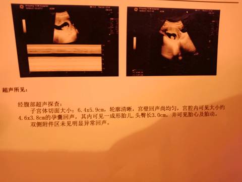 journal_insert_pic_1019848745