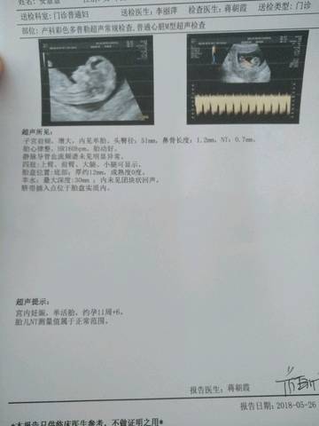 journal_insert_pic_1020330760