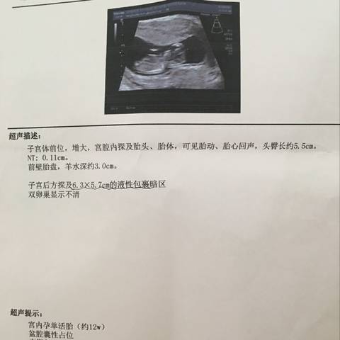 journal_insert_pic_1020283488