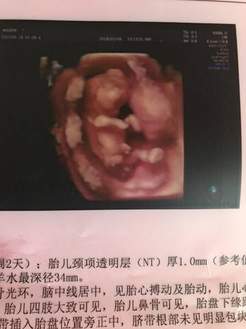 journal_insert_pic_1020827876