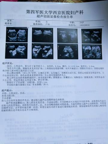 journal_insert_pic_1022701724