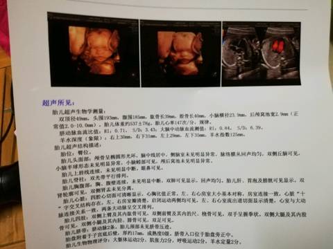 journal_insert_pic_1022943371