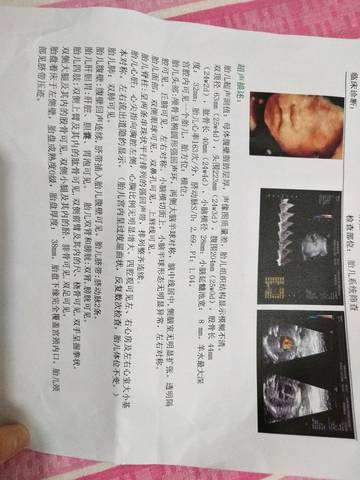 journal_insert_pic_1022804902