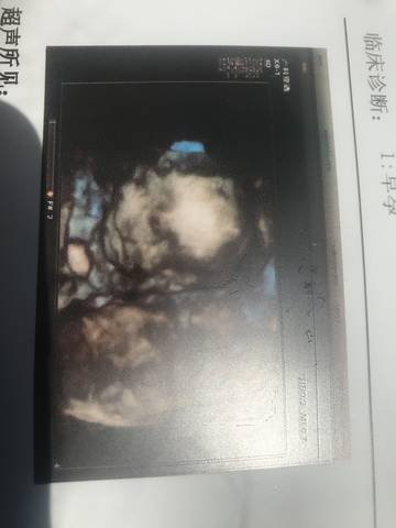 journal_insert_pic_1023217473