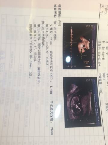 journal_insert_pic_1024585247