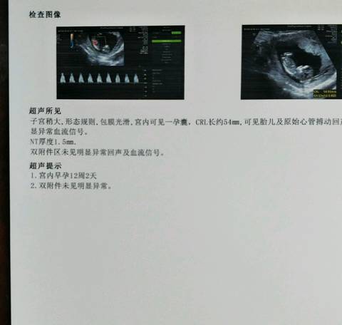 journal_insert_pic_1026179720