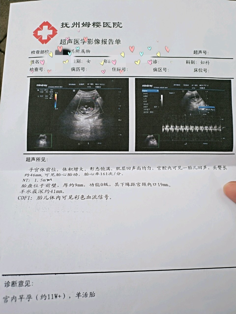 NT归来，不必担心哦宝妈们