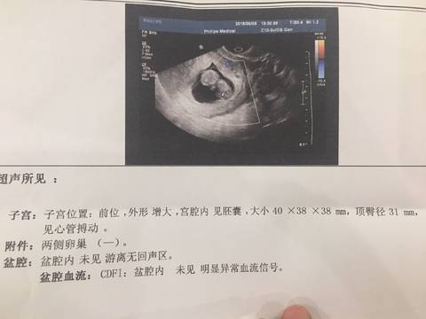 journal_insert_pic_1028150806