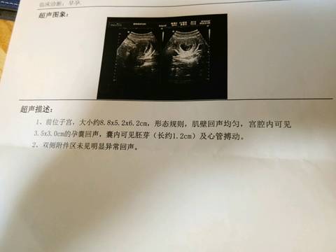journal_insert_pic_1029477987