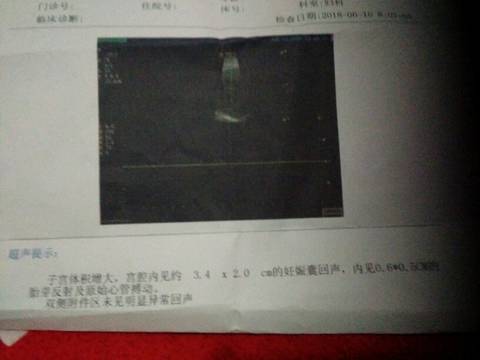 journal_insert_pic_1031905782